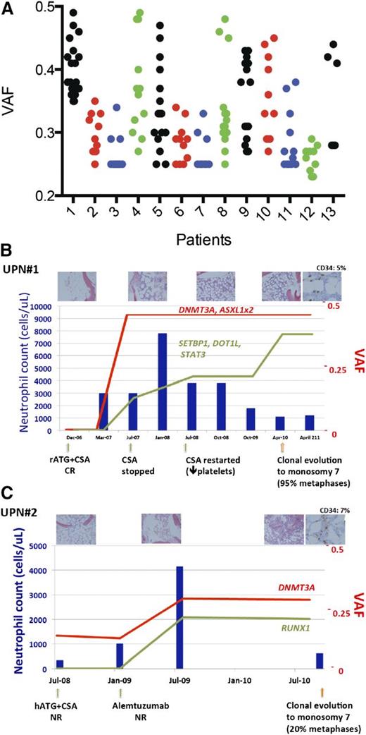 Figure 1. Oligoclonal hematopoiesis at the time of clonal evolution to –7 MDS in SAA patients. (A) Dominant hematopoietic clone VAF in 13 SAA patients at the time of clonal evolution to MDS with −7. Each patient’s mutations with VAF >0.25 are shown. (B-C) VAF of acquired mutations in UPN#1 and UPN#2, with neutrophil count. Direct Sanger sequencing confirmed the presence of mutations and VAF. The upper part of the graph shows representative hematoxylin-eosin staining of the core biopsy and CD34 antigen staining at the time of clonal evolution. The images were taken on an Olympus BX41 microscope with an Olympus DP72 camera, using a 4× UPlanFL N Olympus objective (original magnification ×20). Neutrophil count (left y-axis) is shown by blue bars. VAF of acquired mutations (right y-axis) at various time points from diagnosis of SAA until diagnosis of MDS are shown in red and green line graphs. Arrows on the x-axis mark ISTs and time to progression to MDS.