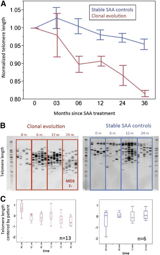 Figure 2. Accumulation of very short telomeres precedes development of –7 MDS in SAA patients. (A) Mean telomere content for clonal evolution group (red line, n = 13) and SAA stable controls (blue line, n = 30) measured by qPCR. For each patient in both groups, mean telomere content at each available time point was normalized to mean telomere content at presentation. (B) Examples of XpYp STELA profile of serial peripheral blood leukocytes for patients from the time of diagnosis of SAA until progression to −7 MDS (left) or SAA controls (right). (C) Quantification of telomere length measured by XpYp STELA. For each of the 2 groups, all available samples at various time points after IST were assayed by both qPCR and STELA. For the clonal evolution group, samples up to the time of −7 diagnosis were used; thus for each time point, at least 4 patients samples were used. Similarly for the SAA control group, 30 patients’ samples were available to 24 months after initial IST; each time point included more than 15 patient samples. For serial blood samples’ telomere length measured by XpYp STELA, average lengths were mean-centered by patient. Discrete bands lengths were quantified using ImageQuant TL software (GE Healthcare Life Sciences, Piscataway, NJ). Bands were quantified based on a standard DNA ladder. A 1-way Wilcoxon test on equal length of the telomeres of the patients over all time points was statistically significant (P = .0027) for the clonal evolution group but not for controls (P = .62).