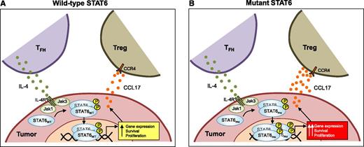 In follicular lymphoma tumors, IL-4 produced by TFH binds to its receptor (IL-4R) on tumor cells and leads to activation of Jak1 and Jak3, which, in turn, results in phosphorylation, dimerization, and translocation of STAT6 to the nucleus. Phosphorylated STAT6 induces genes that may promote survival and proliferation of the tumor cells and also stimulates production of CCL17, which facilitates recruitment of immunosuppressive regulatory T cells (Tregs) via CCR4. Compared with wild-type (wt) STAT6 (STAT6WT) (A), mutant STAT6 (STAT6mu) (B) results in increased localization of STAT6 to the nucleus, especially in the presence of IL-4, and leads to increased expression of genes, including those that might promote survival and proliferation and facilitate immune evasion.