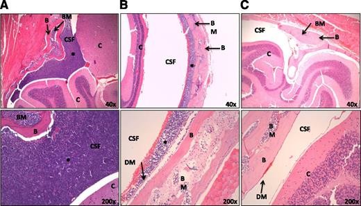 Figure 4. Semiquantitative scoring of CNS infiltration in NSG xenografts. CNS infiltration was determined as described in “Materials and methods.” Hematoxylin/eosin stainings are depicted as examples for the scoring method: (A) ++ scoring (patient Merhigh 3), 1 positive sample; (B) + scoring (patient Merlow 9), 1 intermediate sample; and (C) − scoring (patient Merlow 8), 1 negative sample. Magnification: top panels, ×40; bottom panels, ×200. B, bone; BM, bone marrow; C, cerebrum/cerebellum; DM, dura mater; *, leukemic infiltration.