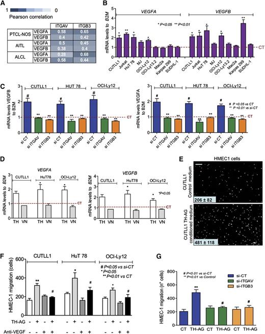 Figure 4. THs contribute to TCL malignant phenotype through angiogenesis induction. (A) Pearson correlation between ITGAV and ITGB3 with VEGFB and VEGFA levels in TCL patients. (B) mRNA levels of VEGFA and VEGFB in the panel of immature and mature TCLs after 24-hour treatment with TH-AG compared with CT. (C) Transcript abundance of VEGFA (right) and VEGFB (left) was evaluated in CUTLL1, HuT78, and OCI-Ly12 cell lines transfected for 48 hours with siRNA against ITGAV (si-ITGAV), ITGB3 (si-ITGB3), or noncoding sequence (si-CT) and then treated for 24 hours with TH-AG or agarose alone (as CT). (D) Transcript abundance of VEGFB (right) and VEGFA (left) was evaluated in CUTLL1, HuT78, and OCI-Ly12 cell lines after 24-hour treatment with 250 ng/mL vitronectin (VN). (E) Induction of HMEC1 cell migration by conditioned medium from CUTLL1 cells treated or not with TH-AG. Representative photographs (scale bar, 60 μm) of the endothelial cells that migrate through the chamber membrane in the presence of CT or conditioned medium. (F) Quantitation of HMEC1 cell migration by conditioned medium from CUTLL, HuT 78, and OCI-Ly12 cells treated or not with TH-AG and preincubated with the anti-VEGF bevacizumab (10 μg/mL) vs vehicle. (G) Cell migration quantitation of HMEC1 cells in the presence or absence of conditioned medium from si-RNA–transfected CUTLL1 cells treated with TH-AG vs CT for 24 hours. Mean ± SEM of at least 3 independent experiments are shown.
