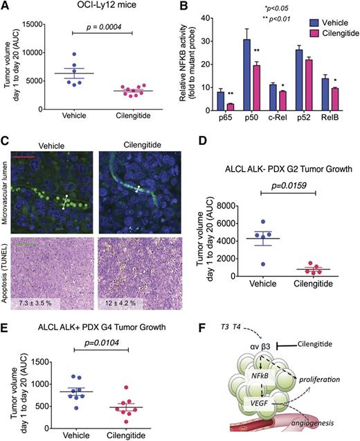 Figure 6. Pharmacologic inhibition of integrin shows anti-lymphoma effect in PTCL-NOS and ALCL mouse models. (A) Tumor volume (measured by AUC, from day 1 to day 20) in OCI-Ly12 xenografted mice treated with vehicle vs cilengitide. (B) DNA-binding capacity of NF-κB family members assessed by an enzyme-linked immunosorbent assay–based assay in extracted nuclear fractions of disaggregated lymphoma tissues from the tumors obtained in panel A. (C) Microvascular lumen (by intravascular isolectin) and apoptotic bodies (by terminal deoxynucleotidyltransferase-mediated dUTP nick end labeling assay) in representative tissue sections of the tumors from vehicle- and cilengitide-treated OCI-Ly12 mice. Scale bar, 25 μm (upper) and 100 μm (lower). The white lines show representative maximum lumen size measurements. (D-E) AUC of tumor growth of ALCL ALK-negative (D) and ALCL ALK-positive (E) patient-derived lymphomas in NSG mice treated with vehicle vs cilengitide. (F) Cartoon representation of TH regulation of TCL prosurvival pathways via the activation of αvβ3 integrins.