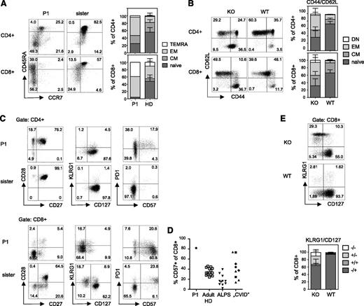 Figure 2. Advanced differentiation of TPP2-deficient T cells. (A) Left panel: peripheral blood mononuclear cells (PBMC) of the patient (P1, age 11 years) and his asymptomatic heterozygous sister (age 7 years) were analyzed for expression of the differentiation markers CCR7 and CD45RA (gated on CD3+CD4+ and CD3+CD8+ T cells, respectively). Right panel (human PBMC): Proportions of naïve (CCR7+CD45RA+, naive), central memory (CM) (CCR7+CD45RA−), effector memory (EM) (CCR7−CD45RA−), and terminal differentiated T-effector memory cells reexpressing CD45RA (TEMRA) (CCR7−CD45RA+) among CD4+ or CD8+ T cells of the patient (P1) compared with adult healthy donors (HD) (n = 20). (B) Left panel: Splenocytes of wild-type (WT) and TTP2-deficient knockout mice (KO) were analyzed for CD62L and CD44 expression (gated on CD3+CD4+ and CD3+CD8+ T cells). Right panel (mouse splenocytes): Proportions of naïve (CD44−CD62L+), CM (CD44+CD62L+), EM (CD44+CD62L−), and double-negative (DN) (CD44−CD62L−) cells were determined among CD4+ or CD8+ T cells of 6 to 12 months old TPP2 deficient knockout mice (KO) (n = 16) compared with age-matched WT mice (n = 7). (C) Expression of the indicated activation/differentiation markers on CD4 and CD8 T cells of the patient (P1) and his healthy heterozygous sister. (D) Percentage of CD57 expressing CD8 T cells in the patient (P1) compared with adult healthy controls, FAS mutant patients with ALPS (pediatric and adult), and pediatric patients with autoimmune cytopenia and lymphoproliferation in the context of CVID. Of these, CVID patients, 2 had LRBA deficiency (diamonds), 2 had activating PIK3CD mutations (squares), and 1 had a CTLA4 mutation (circle). (E) Expression of KLRG1 and CD127 on CD8 T cells of TPP2-deficient (KO) and age-matched WT mice.