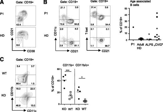 Figure 5. Abnormal B-cell differentiation in TPP2 deficiency. (A-B) Human CD19+ B cells were analyzed for expression of differentiation and senescence markers. The proportion of CD11c+CD21− ABCs was compared between the patient (P1), 8 adult controls (HD), 5 untreated ALPS-FAS patients, and pediatric patients with autoimmune cytopenia and lymphoproliferation in the context of CVID. Patient B cells were analyzed for T-bet expression. (C) The proportions of CD11b+ and CD11b/c+ double-positive splenic CD19+ B cells were determined in 6- to 12-month-old TPP2 knockout (KO) and WT mice (n = 4). The experiment was repeated twice with similar results.