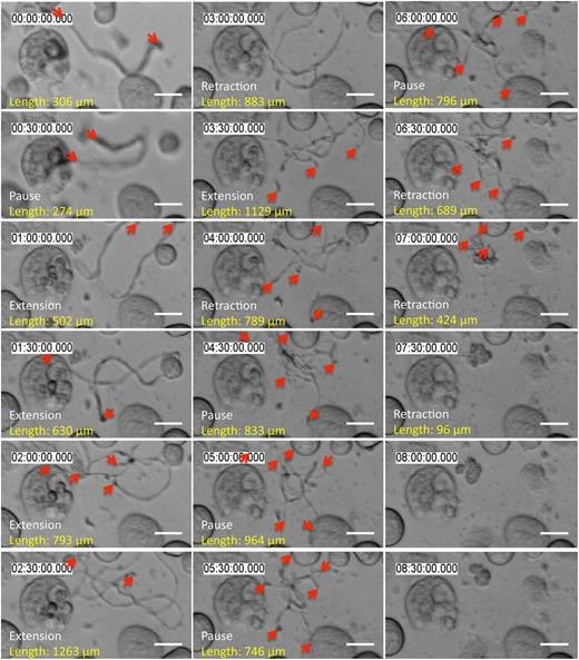 Figure 1. Released proplatelets can elongate, pause, and retract. Representative time-lapse differential interference contrast microscopy: released proplatelets in static tissue culture elongate, pause, and retract over time. Scale bar is 10 µm. Red arrows indicate proplatelet tips.