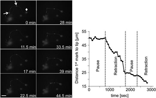 Figure 2. FLAC microscopy enables labeling and observation of proplatelet regions. Representative images of FLAC microscopy performed with MKs expressing β1-tubulin-Dendra2. Two ROIs (white arrows) were photoconverted with a 405-nm laser. Diamond: proplatelet tip. Scale bar is 20 µm. Phases were selected on the basis of an inflection point of the curve.