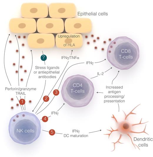 Possible mechanisms of NK cell–mediated acute GVHD. Subclinical GVHD triggers NK cell activation through unknown mechanisms (denoted by “?”), perhaps involving antiepithelial antibodies or expression of stress ligands induced by local inflammation. The resulting NK-cell responses may be targeted directly at epithelial cells (1), or may indirectly activate adaptive immune mechanisms that exacerbate T-cell–mediated GVHD (2-5). Professional illustration by Luk Cox.