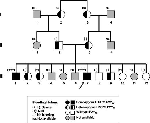 Figure 1. Pedigree of the proband (indicated by an arrow).