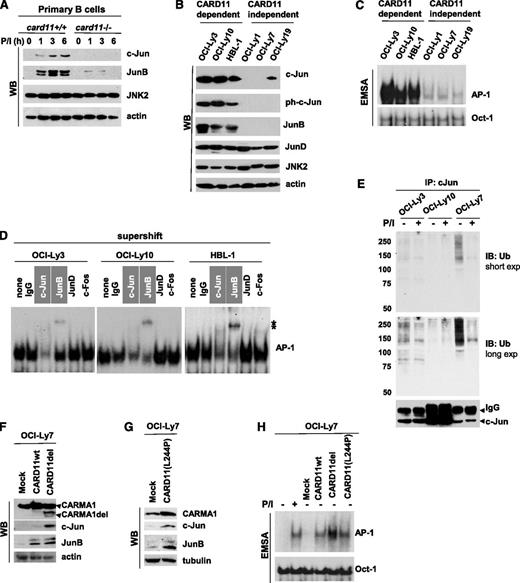 Figure 1. CARD11 regulates c-Jun and JunB level in primary B cells and DLBCL cells. (A) Murine primary B cells were isolated from spleens of wt or CARMA1-deficient mice. The cells (4 × 106 cells per sample) were stimulated with phorbol myristate acetate (PMA) plus ionomycin (P/I; 20 and 100 ng/mL, respectively) for various time points. Whole-cell lysates were subjected to sodium dodecyl sulfate polyacrylamide gel electrophoresis (SDS-PAGE) and analyzed by western blotting using antibodies against c-Jun, JunB, JNK2, or β-actin. (B) Cell lysates were prepared from the indicated lymphoma cell lines and subjected to SDS-PAGE followed by western blotting. (C) Nuclear extracts were prepared from DLBCL cells and analyzed by electrophoretic mobility shift assay (EMSA) by using 32P-labeled probes containing AP-1– or Oct-1–binding sites. (D) For the supershift assay, nuclear extracts were pre-incubated (30 minutes at 4°C) with the indicated antibodies and then subjected to EMSA. (E) c-Jun ubiquitination in lymphoma cell lines. The cells were stimulated with P/I for 5 minutes, and the cell lysates were precipitated with c-Jun antibodies for 16 hours. The immunocomplexes (top panel) and whole-cell lysates (bottom panel) were subjected to SDS-PAGE and analyzed by western blotting by using ubiquitin or c-Jun antibodies. (F-G) OCI-Ly7 cells were stably transfected withCARD11wt, constitutively active CARD11del (the linker region between the coiled-coil and PDZ domains of CARD11 was deleted) or CARD11(L244P) mutant by lentiviral infection. Whole-cell lysates were subjected to SDS-PAGE followed by western blot analysis using the indicated antibodies. (H) OCI-Ly7 cells or cells transduced with the indicated CARD11 constructs were subjected to EMSA to determine AP-1 binding activity. Exp, exposure; IB, immunoblotting; IgG, heavy chain; IP, immunoprecipitation; ph, phosphorylated; Ub, ubiquitin; WB, western blotting; *, shifted band.