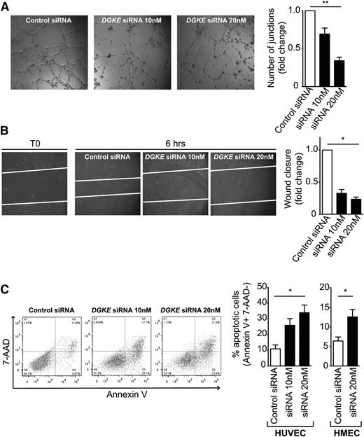 Figure 3. DGKE knockdown in EC impairs their angiogenic responses in vitro by inhibiting migration and increasing apoptosis. (A) Control siRNA– or DGKE siRNA–transfected HUVECs (10 nM and 20 nM, respectively) were seeded on top of a Matrigel matrix and cultured for an additional 6 hours to allow the formation of tubelike structures. A representative photomicrograph of each condition is shown (×10). The bar graph shows quantitative analysis of the mean fold change in the number of junctions between tubes per field (± SEM) vs control siRNA–transfected cells from 4 independent experiments. (B) HUVECs were transfected with control or with 2 concentrations of DGKE siRNAs, and after 48 hours, a linear “scratch” was created in cell monolayers. Migration of cells into this wound was measured after 6 additional hours. Representative photomicrographs (×20) of wounds at 0 hours and after 6 hours are shown; the white lines highlight the linear wound for each group of cells. The bar graph shows the mean fold change in percentage of wound closure vs control siRNA–transfected cells (± SEM), from 3 independent experiments. (C) HUVECs and HMECs transfected with control or DGKE siRNAs were stained with Annexin V and 7-AAD 48 hours after transfection to evaluate apoptosis by flow cytometry. Representative dot plots are shown on the left, and the bar graph represents the mean percentage (± SEM) of apoptotic cells (Annexin V+ and 7-AAD−) from 4 independent experiments. *P < .05, **P < .01.