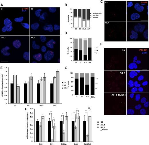 Figure 6. RUNX1 DN-like mutant induces increased genomic instability compared with RUNX1 haploinsufficiency. AII_1 and AII_2 are iPSC clones of 2 patients from pedigree A; D(a) is 1 clone of 1 patient from pedigree D; AII_1_RUNX1 is the iPSC clone AII_1 overexpressing WT RUNX1; D(a)_shRUNX1_1 is the iPSC clone D(a) after RUNX1 knockdown by shRUNX1_1; and C2 and C3 are control iPSC lines. (A-B) CD43+ cells and (C-E) CD34+CD43+ cells were sorted at day 14 of culture. (A,C) Representative photos are shown; nucleus is stained with 4,6 diamidino-2-phenylindole (DAPI; blue) and double-strain breaks (DSBs) are stained (A) with P-H2AX (red) or (C) with p53-BP1 (red). The number of (B) P-H2AX and (D) P53-BP1 foci per 50 counted cells is shown. One representative experiment of 4 is shown (P < .0001 for the increase in P-H2AX–positive cells; P = .0164 for the increase in P53BP1-positive cells in pedigree A). (E) qRT-PCR analysis of different p53-dependent genes in CD34+CD43+ cells. Data are normalized to PPIA transcript level and expression is compared with control C2. The histograms show 1 representative experiment of 3, each in triplicate. Error bars represent 95% CIs. (F-H) CD14+CD15+ cells were sorted at day 15 of culture. (F) Representative photos are shown; nucleus is stained with DAPI (blue) and DSBs are stained with P53BP1 (red). (G) The number of P53BP1 foci per 100 counted cells is shown. One representative experiment of 3 is shown (P = .0017 for the increase in P53BP1-positive cells in AII_1). (H) qRT-PCR analysis of different p53-dependent genes in CD14+CD15+ cells. Data are normalized to PPIA transcript level and expression is compared with control C3. The histograms show 1 representative experiment of 3, each in triplicate. Error bars represent 95% CIs. *P < .05; **P < .01; ***P < .001; Student t test.