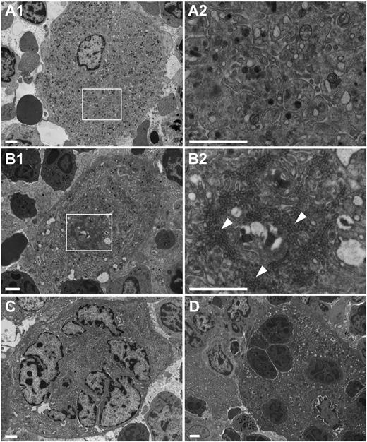 Figure 2. Altered bone marrow Dnm2fl/fl Pf4-Cre MK ultrastructure. Transmission electron microscopy analysis of bone marrow Dnm2fl/fl MKs (A) and Dnm2fl/fl Pf4-Cre MKs (B-D). Areas within boxes in panels A1 and B1 are shown at higher magnification in panels A2 and B2, respectively. Arrowheads point to clathrin-coated vesicles. Bars represent 2 µm.