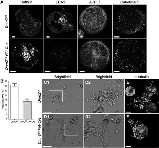 Figure 3. Impaired endocytic pathway and proplatelet formation in Dnm2-null MKs. (A) Representative clathrin heavy chain, EEA1, APPL1, and calreticulin immunofluorescence images of Dnm2fl/fl and Dnm2fl/fl Pf4-Cre bone marrow MKs. Bars represent 10 µm. (B) Dnm2fl/fl (n = 10) and Dnm2fl/fl Pf4-Cre (n = 16) fetal liver–derived MKs extending proplatelets were counted 18 hours after BSA gradient (day 4 of culture) and expressed as percentage of total MKs (mean ± SEM; ***P < .0001). Representative light microscopy images of fetal liver–derived Dnm2fl/fl (C) and Dnm2fl/fl Pf4-Cre (D) MK-forming proplatelets in vitro. Areas within boxes in panels C1 and D1 are shown at higher magnification in panels C2 and D2, respectively. Bars represent 50 µm. Representative α-tubulin immunofluorescence images of fetal liver–derived Dnm2fl/fl (E) and Dnm2fl/fl Pf4-Cre (F) MK-forming proplatelets in vitro. Bars represent 20 µm.