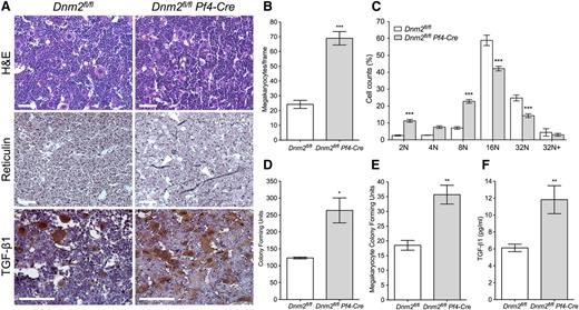 Figure 5. Bone marrow MK hyperplasia and MF in Dnm2fl/fl Pf4-Cre mice. (A) H&E, reticulin, and TGF-β1 staining of Dnm2fl/fl and Dnm2fl/fl Pf4-Cre femur bone marrow sections. Sections shown are representative of 5 mice for each genotype. Arrowheads in panel A (middle row) point to reticulin fibers. Bars represent 20 µm. (B) Dnm2fl/fl and Dnm2fl/fl Pf4-Cre bone marrow MK counts (mean ± SEM; n = 5 in each group; ***P < .0001). (C) Percentage of bone marrow Dnm2fl/fl and Dnm2fl/fl Pf4-Cre MK ploidy (mean ± SEM; n = 5 in each group; ***P < .001). (D) Bone marrow CFUs in Dnm2fl/fl and Dnm2fl/fl Pf4-Cre mice (mean ± SEM; n = 6 in each group; *P = .0188). (E) Bone marrow MK CFUs in Dnm2fl/fl and Dnm2fl/fl Pf4-Cre mice (mean ± SEM; n = 6 in each group; **P = .0034). (F) Bone marrow TGF-β1 levels in Dnm2fl/fl and Dnm2fl/fl Pf4-Cre mice (mean ± SEM; n = 6 in each group; **P = .0044).