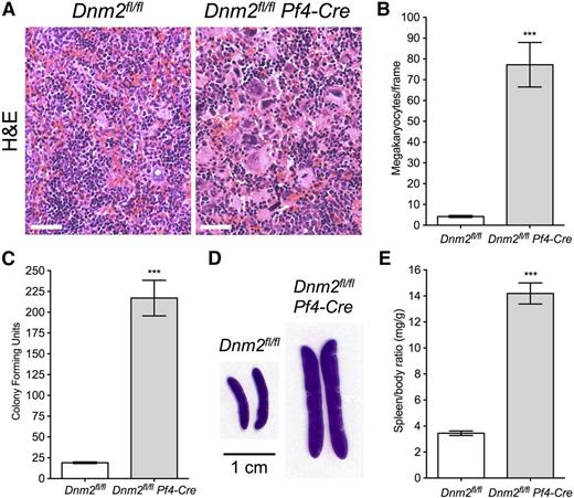 Figure 6. Extramedullary hematopoiesis and splenomegaly in Dnm2fl/fl Pf4-Cre mice. (A) H&E staining of Dnm2fl/fl and Dnm2fl/fl Pf4-Cre spleens. Sections shown are representative of 5 mice for each genotype. Bars represent 20 µm. (B) Dnm2fl/fl and Dnm2fl/fl Pf4-Cre spleen MK counts (mean ± SEM; n = 5 in each group; ***P < .0001). (C) Spleen CFUs in Dnm2fl/fl and Dnm2fl/fl Pf4-Cre mice (mean ± SEM; n = 6 in each group; ***P = .0008). (D) Dnm2fl/fl and Dnm2fl/fl Pf4-Cre spleen sections. Sections shown are representative of 15 mice for each genotype. (E) Spleen/body weight ratios of Dnm2fl/fl and Dnm2fl/fl Pf4-Cre mice (mean ± SEM; n = 15 in each group; ***P < .0001).