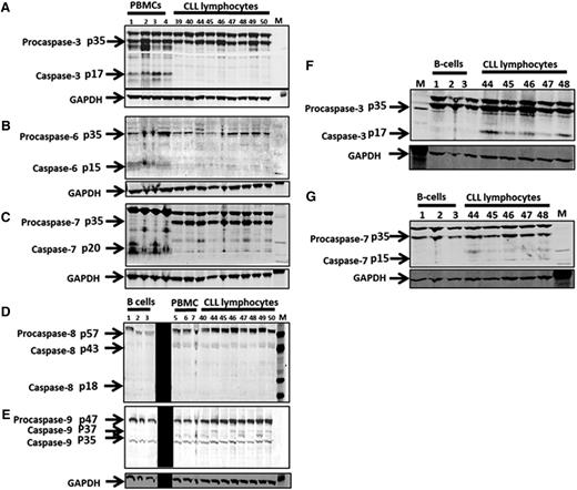 Figure 1. Protein expression of executioner and effector procaspases in PBMCs, normal B lymphocytes, and CLL lymphocytes. Fresh samples of normal PBMCs from peripheral blood samples obtained from healthy donors (n = 4), leukemic lymphocytes from peripheral blood samples obtained from patients with CLL (n = 9), and commercially available pure B lymphocytes (n = 3) were collected and processed for immunoblot analysis. Executioner caspases, pro- and caspase-3 protein expression (A), pro- and caspase-6 protein expression (B), pro- and caspase-7 protein expression (C) in PBMCs and CLL lymphocytes are presented. Effector caspases, pro- and caspase-8 (D) and pro- and caspase-9 (E) are shown from B cells, PBMCs, and CLL cells. Executioner caspases, pro- and caspase-3 (F), and pro- and caspase-7 (G) from normal B and CLL lymphocytes are presented. GAPDH is used as loading control for all. M denotes protein molecular weight marker. The black strip in panels D and E was used to block technically weak lanes. GAPDH, glyceraldehyde-3-phosphate dehydrogenase.