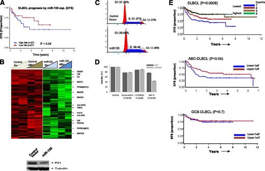 Figure 5. Association of miR-155 with rituximab resistance and target identification. (A) Association of miR-155 expression with EFS in DLBCL. (B) GEP analysis of miR-155-regulated genes and western blot detection of cyclin-dependent kinase inhibitor 1A (CDKN1A) (p21) (only downregulated genes are shown). (C) Cell-cycle analysis in miR-155 overexpressing DHL16 cells. (D) miR-155-expressing cells were more sensitive to AKT IV inhibition, compared with other inhibitors. (E) The 3-gene miR-155 signature was predictive of treatment failure in DLBCL in the entire cohort (upper) and in the ABC-DLBCL subgroup, but not in GCB-DLBCL (lower). EFS is shown using expression quartiles (Q) of the 3-gene signature in the entire cohort, but divided in halves in subgroup analysis.