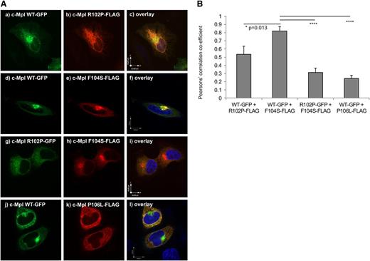 Figure 6. The c-MPL F104S, but not the P106L-mutated receptors heterodimerize with the WT receptor. (A) Representative confocal images of transiently cotransfected HeLa cells. The (Aa, Ad, and Aj) c-Mpl WT-GFP or (Ag) c-Mpl R102P-GFP, respectively, harboring a GFP expression sequence in frame at the C-terminus and (Ab) c-Mpl R102P-FLAG, (Ae and Ah) F104S-FLAG, or (Ak) P106L-FLAG mutated constructs with a FLAG-tag sequence in frame at the C-terminus were cotransfected with equal amounts of DNA and fixed 48 hours later. The FLAG-tag was visualized with a mouse anti-FLAG M2 primary antibody and an anti-mouse secondary antibody linked to Alexa 568 as described in “Materials and methods.” (Aa, Ab, and Ac) Cotransfection of c-Mpl WT-GFP and c-Mpl R102P-FLAG. (Ad, Ae, and Af) Cotransfection of c-Mpl WT-GFP and c-Mpl F104S-FLAG. (Ag, Ah, and Ai) Cotransfection of c-Mpl R102P-GFP and c-Mpl F104S-FLAG. (Aj, Ak, and Al) Cotransfection of c-Mpl WT-GFP and c-Mpl P106L-FLAG. Panels Ac, Af, Ai, and Al represent the respective overlays of the cotransfection experiments. Images were acquired using a spinning-disc confocal microscope with a ×100 oil immersion objective. Bars represent 10 µm. Cells depicted represent the subcellular distribution pattern seen in >90% of the transfected cells. (B) Pearson’s correlation coefficient of the cotransfection experiments described in (A) (n = 5). The coefficient was acquired with the Volocity 5.5 software using the automatic threshold function. The ROI was defined as a 10 × 10-µm square with the Golgi set as the middle for the ROI. *P = .013; ****P < .0001.