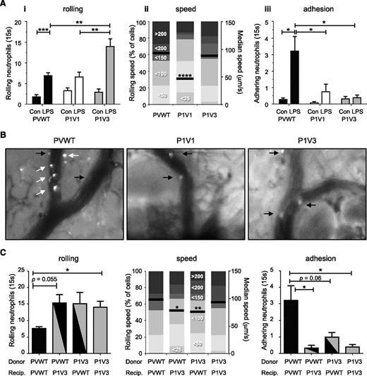 Figure 3. Altered neutrophil rolling and impaired adhesion in airway postcapillary venules of P1V1 and P1V3 mice during acute LPS-induced lung inflammation. (A) Altered neutrophil rolling and impaired adhesion in airway postcapillary venules of P1V1 and P1V3 mice during LPS-induced lung inflammation. Mice were challenged with LPS as in Figure 3 and intravital microscopy was performed by taking 15-second videos of 5 to 10 of the airway postcapillary venules/mouse. Numbers of rolling neutrophils (i), rolling velocity (ii; mean velocity and speed categories), and firm adhesion (iii) were assessed by video analysis. Data are mean ± SEM of 4 to 5 mice/group for numbers of rolling and adhering cells. Rolling velocity is median speed of ≥90 cells/genotype; statistics unpaired Student t test between sham- and LPS-treatment or Kruskal-Wallis test with Dunn’s multiple comparisons for genotypes. (B) Representative images of LPS-induced neutrophil recruitment in airway postcapillary venules. Inflammation was induced with LPS and was monitored by airway intravital microscopy as in (A). Images are stills from representative videos. White arrows denote firmly adhering neutrophils (stationary throughout recording), and black arrows show cells rolling along the vessel wall. (C) Neutrophil-intrinsic and neutrophil-extrinsic factors are sufficient to impair LPS-induced pulmonary neutrophil recruitment in P1V3 mice. Mice were lethally irradiated, their hematopoietic system was reconstituted with bone marrow, as indicated, LPS-dependent lung inflammation was induced after reconstitution, and pulmonary neutrophil recruitment was assessed by intravital microscopy as in (A). Data are mean ± SEM of 4 to 5 mice/group; statistics as in (A).