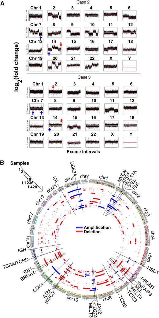 Figure 2. Copy number variation analysis of HRS cells. (A) Representative results for all chromosomes for case 2 (top) and case 3 (bottom) are shown. HRS cells vs T-cell exon copy number changes are plotted on log2 scale. Case 2 had a relatively high frequency of copy number alterations, whereas case 3 had relatively fewer. Focal losses of the immunoglobulin genes are seen in chromosomes 14, 2, and 22 (red arrows), and gains in the TCR genes on chromosomes 7 and 14 (blue arrows). (B) Circos plot showing the segments containing copy number variations in the 10 primary cases of cHL plus the 2 cell lines sequenced. The samples correspond to cases 1 through 10 beginning at the outermost ring and followed by cell lines L1236 and L428 in the inner circle. Important oncogenes, such as REL, can be seen recurrently amplified (blue), and tumor suppressors (eg, ATM) can be seen recurrently deleted (red).