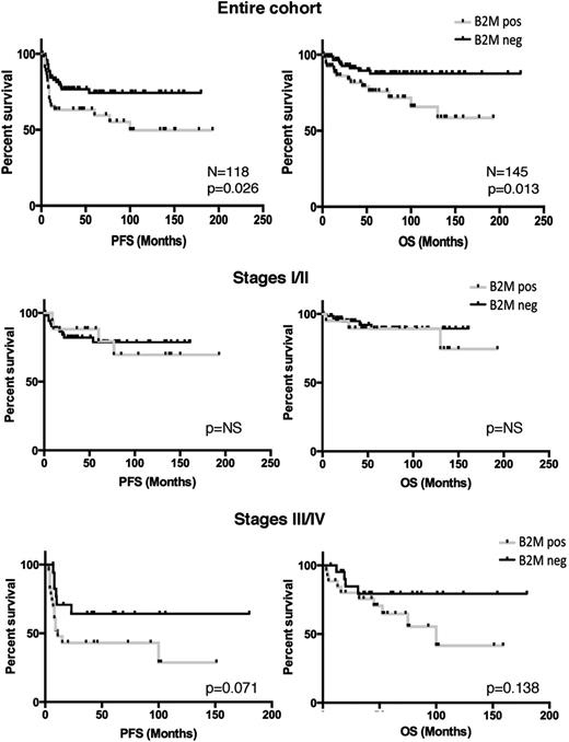 Figure 6. Lack of expression of B2M is associated with a better clinical outcome in advanced disease. Kaplan-Meier curves of cases with clinical information show that positivity for B2M by immunohistochemistry in the HRS cells associates with a poor progression-free survival (PFS) and overall survival (OS), as compared with cases that lack B2M expression in the entire cohort (top row). The middle row shows Kaplan-Meier curves for patients with stages I and II cHL; the bottom row shows Kaplan-Meier curves for patients with stages III and IV cHL. Among patients with advanced stage, but not in patients with early-stage cHL, positivity for B2M by immunohistochemistry in the HRS cells showed a trend for poor OS, as compared with cases that lack B2M expression. NS, not significant.