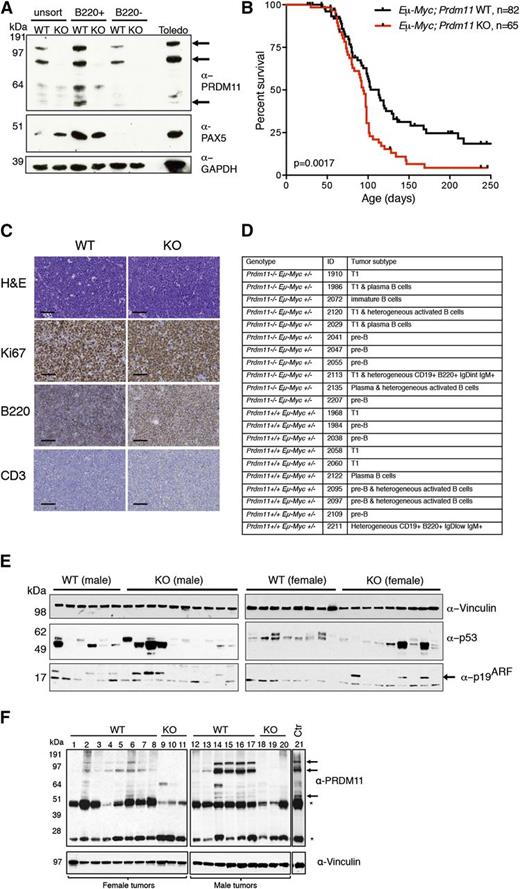 Figure 2. Loss of Prdm11 accelerates MYC-induced lymphomagenesis in vivo. (A) IB of unsorted, B220+, and B220– murine splenocytes from Eµ-Myc–;Prdm11 WT and Eµ-Myc–;Prdm11 KO mice. PAX5 was used as a sorting control and GAPDH served as a loading control. The arrows mark the 3 major PRDM11 protein species, which are also present in the human Toledo lymphoma cell line detected by α-PRDM11 monoclonal antibody (n = 2). (B) Kaplan-Meier plot of survival probability of Eµ-Myc;Prdm11 WT (n = 82) and Eµ-Myc;Prdm11 KO (n = 65) mice. Tumors occurred earlier in Eµ-Myc+;Prdm11 KO mice (P = .0017, log-rank test). (C) Representative micrographs of end-stage LN tumors from Eµ-Myc;Prdm11 WT or Eµ-Myc;Prdm11 KO mice immunostained with Ki67, B220, or CD3 antibodies. Scale bar = 50 µm. (D) Summary of immunophenotypes of lymphomas from mice with the indicated genotypes. T1: transitional T1 B cell. (E) IB analysis of the p53-p19ARF pathway in a panel of end-stage splenic tumors from male (left) and female (right) Eµ-Myc;Prdm11 WT or Eµ-Myc;Prdm11 KO mice. High p53 protein levels, indicative of missense mutations in p53, were detected in 6 of 14 WT tumors and 8 of 20 KO tumors (P > .05, Fisher’s exact test), whereas loss of p19ARF was seen in 10 of 14 WT tumors and 13 of 20 KO tumors (P > .05, Fisher’s exact test). Vinculin served as loading control. p19ARF is marked by an arrow. The male and female tumors were run on separate gels. (F) IB of PRDM11 in a panel of splenic end-stage EµMyc;Prdm11 WT tumors. EµMyc;Prdm11 KO tumors and control (spleen from C57BL/6 mouse) were used as controls (Ctr) for the specificity of the α-PRDM11 monoclonal antibody. The 3 major PRDM11 protein species are indicated by arrows; asterisks mark endogenous immunoglobulin heavy and light chains. Vinculin served as loading control.