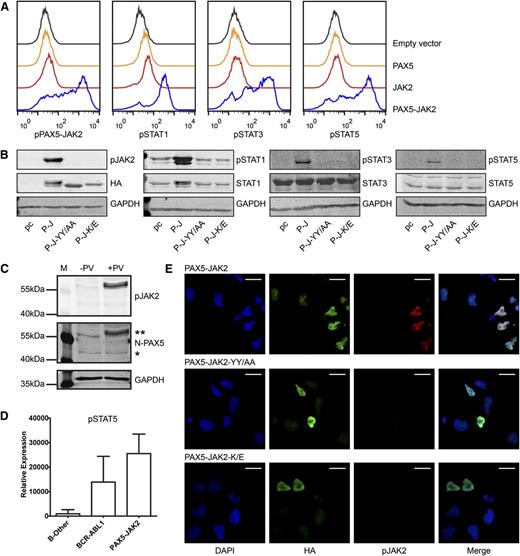 Figure 2. PAX5-JAK2 is phosphorylated and activates STAT proteins. (A) Intracellular phosphoprotein analyses using flow cytometry were performed in JAK2-deficient γ2a cells transfected with the indicated proteins. One of 3 representative experiments is shown. Black lines, empty vector, pIRES2-EGFP; orange lines, PAX5; red lines, JAK2; blue lines, PAX5-JAK2. (B) Western blotting of whole cell lysates of γ2a cells. pc, pcDNA3 empty vector; P-J, PAX5-JAK2; P-J-YY/AA, tyrosine mutant; P-J-K/E, kinase dead mutant (GAPDH ∼ 37 kDa, HA ∼ 60 kDa, pJAK2 ∼ 60 kDa, STATs/pSTATs ∼ 90 kDa). (C) PAX5-JAK2 phosphorylation detected in whole cell lysate of a bone marrow sample of a PAX5-JAK2+ patient. −PV, without pervanadate; +PV, treated with phosphatase inhibitor pervanadate; **PAX5-JAK2; *PAX5. (D) pSTAT5 levels in bone marrow cells of patients with PAX5-JAK2+ (n = 2), BCR-ABL1+ (n = 33) or B-other (n = 43) leukemia were measured by reverse phase protein arrays, and levels were normalized for total protein levels in each cell lysate. (E) Immunofluorescence was performed in HeLa cells transfected with (top) HA-tagged PAX5-JAK2, as well as with the mutated forms (middle) PAX5-JAK2-YY/AA and (bottom) PAX5-JAK2-K/E using an HA (green) and a p-Y1007/8-JAK2 (red) antibody and DAPI (blue) for DNA counterstaining. Images were acquired on a Leica TCS SP5 equipped with an HCX PL APO CS 63.0×1.40 oil objective in sequential scan mode using identical settings for all conditions. White bars indicate 20 µm.