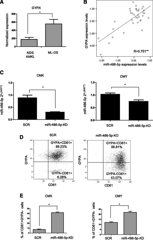 Figure 4. miR-486 is important for the ML-DS erythroid phenotype. (A) GYPA (glycophorin A and CD235) expression in diagnostic BM of ML-DS patients (n = 25) compared with non–DS-AMKL (n = 38), published microarray data.3 (B) Pearson correlation test between the expression level of GYPA and miR-486-5p determined by qRT-PCR in diagnostic BM of 36 ML-DS patients. **Correlation was statistically significant, P < .01 (ANOVA). (C) Expression of miR-486-5p in CMK and CMY ML-DS cells stably expressing shRNA anti–miR-486-5p (miR-486-5p-KD) or SCR. (D) GYPA and CD61 expression in CMK ML-DS cells stably expressing shRNA anti–miR-486-5p or SCR determined by flow cytometry. (E) Increase of cells with pure megakaryocytic phenotype (GYPA− and CD61+) in CMK and CMY ML-DS cells stably expressing shRNA anti–miR-486-5p in comparison with SCR. *P < .01 (2-tailed Student t test). SCR, scrambled.