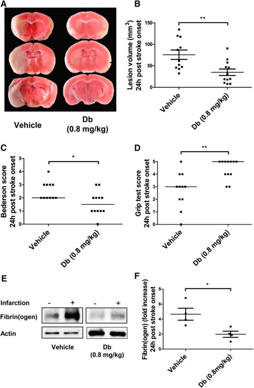 Figure 2. Evaluation of the diabody in a model of cerebral ischemia (60 minutes) and reperfusion. Representative triphenyltetrazolium chloride–stained brain slices (A), lesion volume (B), Bederson score (C), and Grip test score (D) of mice treated with vehicle or Db (0.8 mg/kg) alone on reperfusion (60 minutes postocclusion). (E) Representative immunoblots of ipsilateral vs contralateral hemispheres. (F) Fibrin(ogen) contents in ipsilateral hemisphere (fold increase vs contralateral hemisphere) of mice treated with vehicle or diabody (0.8 mg/kg) on reperfusion (60 minutes postocclusion). All parameters were measured 24 hours after stroke onset. Data are represented as mean ± SEM (panels B,F) or median (panels C-D); n = 10-12 mice per group (panels B-D); n = 4 mice per group (panel F). *P < .05; **P < .01.