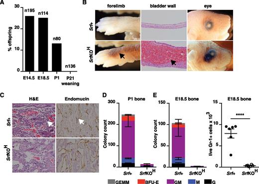Figure 1. Early hematopoietic inactivation of Srf causes perinatal lethality and lack of bone marrow cellularity. (A) Embryos or animals were genotyped at the indicated stages and proportion of SrfKOH (vav-iCre; Srff/f) scored; n = total embryos/animals genotyped. (B) Hemorrhage into skin, bladder, or eye in newborn SrfKOH compared with Srf+ (Srff/f, Srff/+) animals. (C) P1 femurs stained with hematoxylin and eosin (H&E) (left) or endomucin (right). (D) Colony-formation assays with cells from the P1 femur of SrfKOH animals. Data are from 3 Srf+ and 3 SrfKOH animals, each assay was performed in triplicate. See supplemental Figure 1A. (E) Left, reduced colony-formation activity in hind-limb long bones of E18.5 SrfKOH animals. Data are from 5 Srf+ and 3 SrfKOH embryos; each assay was performed in triplicate. Right, Gr-1+ cellularity in E18.5 long bones. Data are from 6 embryos of each genotype (P < .0001; unpaired Student t test).