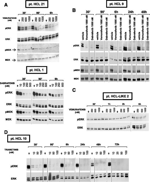 Figure 1. Vemurafenib, dabrafenib, and trametinib cause sustained, dose-dependent MEK and ERK dephosphorylation in primary HCL but not HCL-like cells. (A-B, D) Western blot analysis of purified HCL cells from 4 representative patients shows strong phosphorylation of both MEK and ERK under basal conditions (0 nM drug, ie, DMSO vehicle only) and their dose-dependent dephosphorylation after 30 minutes to 72 hours of incubation with the specific active BRAF inhibitors vemurafenib and dabrafenib (A-B) at concentrations ranging from 100 nM to 1000 nM, and with the MEK inhibitor trametinib (D) at concentrations ranging from 10 nM to 100 nM. (C) Conversely, primary leukemic cells from a representative HCL-like patient express a relatively low basal level of phospho-ERK which is not influenced by treatment with up to 1000 nM vemurafenib for 30 minutes to 6 hours. Membranes were probed with antibodies against phospho-ERK1/2 (pERK), phospho-MEK1/2 (pMEK), total ERK1/2, and total MEK1/2 as indicated on the left of each panel. Please note that to obtain, from the HCL-like cell lysates, the pERK bands representatively shown in panel C, the exposure of the pERK blot had to be prolonged (tens of minutes) as compared with HCL cell lysates (tens of seconds in A-B). Solid and dashed lines separate lanes repositioned from the same gel and, respectively, lanes taken from different gels.