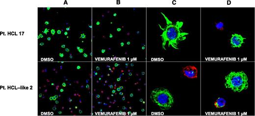 Figure 4. BRAF inhibition trims the hairy projections of HCL but not HCL-like cells. Confocal immunofluorescence staining for phalloidin (green), annexin V (red) and Draq5 (blue) in primary leukemic cells purified from the blood of a representative HCL patient (no. 17, top panels) and a representative HCL-like patient (no. 2, bottom panels) and treated in vitro with vehicle (DMSO) or vemurafenib 1 µM (for 48 and 72 hours in the HCL and HCL-like patient, respectively). (A-B) Two-dimensional (2D) images of a representative field (×63 optical magnification with oil immersion). (C-D) Electronically magnified 2D-image of a representative cell for each condition.