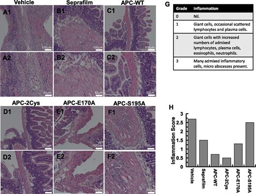 Figure 5. Peritoneal tissue histology in 2 different magnifications. Representative images are derived from saline-treated control group (A1, A2), Seprafilm group (B1, B2), APC-WT group (C1, C2), APC-2Cys group (D1, D2), APC-E170A group (E1, E2), and APC-S195A (F1, F2). The numerical scoring of inflammation based on histology (G) is shown in panel (H).