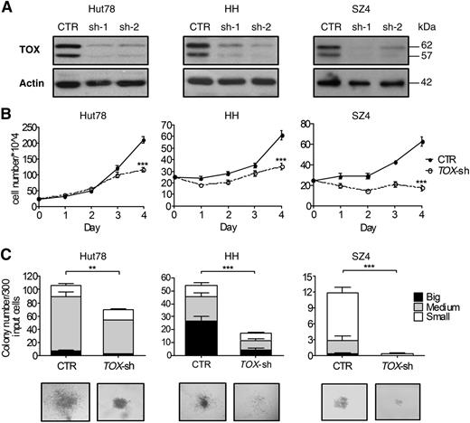 Figure 3. TOX suppression confers growth disadvantage to CTCL cells. (A) TOX knockdown by 2 shRNA (sh-1 and sh-2, both specific for TOX mRNA) compared to control (CTR) CTCL cells transduced by a nontargeting shRNA. Transduced cells were selected by puromycin (1 μg/mL) for 5 days before protein lysates were probed with antibodies against TOX and actin proteins. (B) TOX-sh cells had a much reduced viable cell number over a period of 4 days compared to CTR cells. A total of 2.5 × 105 cells were cultured in 2 mL of full RPMI media for 4 days, and viable cells were determined each day by the trypan blue exclusion method. (C) TOX-sh cells generated fewer and smaller colonies in 3-dimensional culture compared to CTR cells. Three hundred cells were plated in 1.5 mL of methycellulose, and colony numbers and morphology were recorded on day 12. Numbers of colonies of different sizes (big, medium, and small) are depicted. Photographs of representative colonies are also shown. Original magnification ×10. **P < .01 and ***P < .001 by 2-tailed Student t test with Welch correction. Error bars indicate standard error of the mean. Data shown here are representative of at least 3 independent experiments.