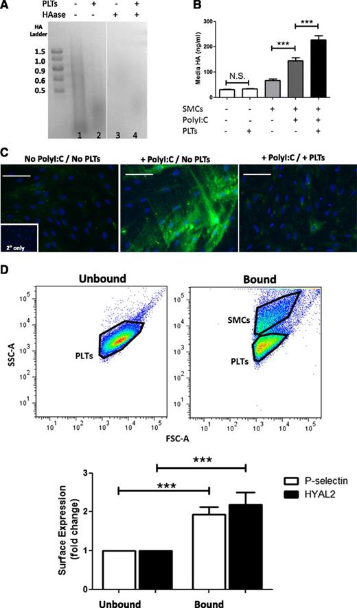 Figure 1. Platelets digest HA in the inflammatory matrix. PolyI:C-stimulated human M-SMCs were co-incubated with freshly isolated human platelets (PLTs) for 2 hours at 37°C. (A) Agarose gel electrophoretic analysis of HA purified from polyI:C-stimulated M-SMCs before (lane 1) and after (lane 2) coincubation with platelets. Polydisperse HA with a size range of 0.1 to 2 × 106 Da associated with M-SMCs was no longer detected after co-incubation with platelets. Replicate samples were treated with HAase, an enzyme that specifically digests HA, to confirm that the stained bands were HA (lanes 3 and 4). HA ladder units: 106 Da. (B) ELISA-like assay measurement of HA released into the media by M-SMCs. Coincubation of M-SMCs with platelets results in a significant increase of HA in culture media. Data represent mean ± standard error (SE) of 10 separate experiments. ***P < .001; N.S., not significant. (C) Histochemical staining of M-SMC-associated HA (green). M-SMCs were fixed in cold methanol, and HA was detected with biotinylated HA-binding protein and Alexa Fluor 488–conjugated streptavidin. M-SMCs responded to polyI:C treatment by producing high amounts of HA. The co-incubation of platelets with polyI:C-stimulated M-SMCs caused the removal of the M-SMC surface–associated HA. Image and capture details: Leica upright microscope DM5500 B (Leica, Wetzlar, Germany), HC PLAN APO ×20/0.7NA dry objective, QImaging Retiga cooled CCD camera, QCapture Suite Software (QImaging, Surrey, BC Canada). Scale bar: 100 µm. (D) Fold-increase in surface P-selectin and HYAL2 mean fluorescence intensity (MFI) of SMC-bound platelets in comparison with unbound platelets following culture as measured by flow cytometry. SMC-bound platelets demonstrated significantly higher surface P-selectin and HYAL2 compared with unbound platelets after culture. Platelets were defined by forward (FSC-A), and side scatter (SSC-A) characteristics.