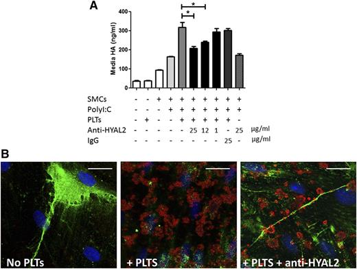 Figure 2. Platelets degrade proinflammatory matrix HA using HYAL2. PolyI:C-stimulated human M-SMCs were co-incubated with untreated freshly isolated human platelets or with HYAL2 blocking antibody–treated platelets for 2 hours at 37°C. (A) ELISA-like assay measurement of the amounts of HA released into the media by M-SMCs. Coincubation of stimulated M-SMCs with HYAL2 antibody–treated platelets resulted in a significant decrease in HA released into media compared with untreated or IgG-treated platelets (n = 3; *P < .05). The inhibiting effect of the HYAL2 blocking antibody was dose dependent. (B) Histochemical staining of M-SMC–associated HA (green) and platelets (red = CD42b) in the absence or presence of HYAL2 antibody. Whereas untreated platelets degraded HA on stimulated M-SMCs, HYAL2 antibody–treated platelets bound HA cables on the surfaces of M-SMCs without degrading them. Image, detection, and software details: Leica TCS SP5 II confocal/multi-photon high-speed upright microscope (Leica), HCX PL APO ×40/1.25NA oil immersion objective, Leica HyD system detector, Leica LAS AF software (Leica). Scale bar: 25 µm.
