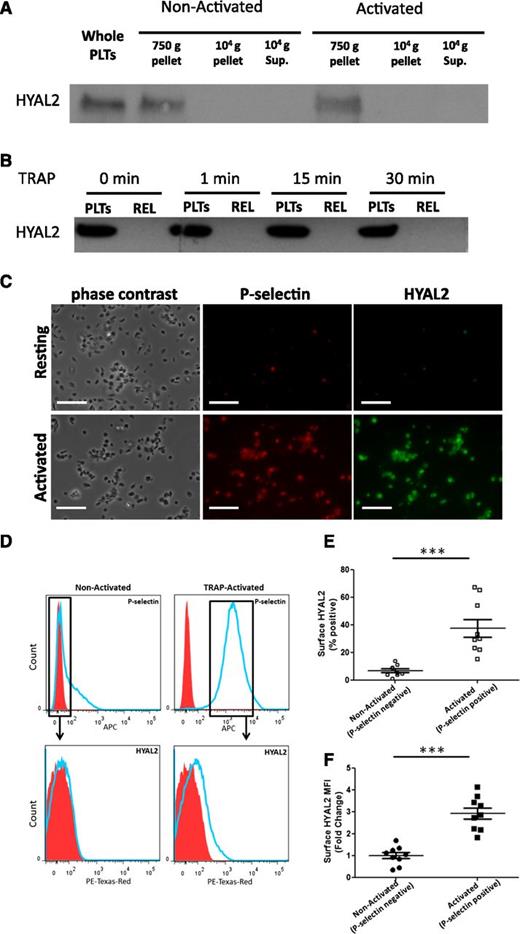 Figure 4. HYAL2 becomes surface expressed upon thrombin receptor–mediated platelet activation. (A) Freshly isolated human platelets were treated without or with TRAP (15 µM) for 10 minutes before microparticles were isolated. Immunoblot analysis showed that, upon activation, HYAL2 was associated with platelets (750-g pellet) and not with microparticles (104-g pellet) or platelet releasate (104 g supernatant). (B) Immunoblot analysis showing that HYAL2 remains associated with platelets (750-g pellet) and not with microparticles or releasate (REL) even after 30 minutes incubation with TRAP. (C) Freshly isolated human platelets were treated without or with TRAP (25 µM) for 1 minute before they were fixed with 3.5% paraformaldehyde for 30 minutes. Fixed platelets were spun down onto slides coated with poly-l-lysine and stained for P-selectin (red) and HYAL2 (green). Similar to P-selectin, HYAL2 was detected only on the surfaces of activated platelets. Image and software details: Leica upright microscope DM5500 B (Leica), HCX PLAN APO ×63/1.32NA oil immersion objective, QImaging Retiga cooled CCD camera, QCapture Suite Software (QImaging). Scale bar: 20 µm. (D-F) Freshly isolated platelets were treated without or with TRAP (25 µM) for 1 minute at room temperature before they were fixed in 1% paraformaldehyde for 2 hours at room temperature. Fixed platelets were stained for HYAL2 and P-selectin and analyzed by using flow cytometry. (D) Representative histograms of surface P-selectin and HYAL2 staining in unstimulated and TRAP-stimulated platelets. The P-selectin–negative population in unstimulated platelets demonstrated no surface HYAL2 expression, whereas the P-selectin–positive population in the TRAP-stimulated sample showed significant surface HYAL2 expression. PE, phycoerythrin. (E) Percentage of surface HYAL2-positive platelets measured by flow cytometry. As a result, 37.6% ± 6.4% (±SE) of TRAP-activated platelets expressed surface HYAL2 compared with only 6.8% ± 1.3% of nonactivated (P-selectin negative) platelets. n = 9; ***P < .001. (F) Fold-increase in surface HYAL2 MFI of TRAP-activated platelets in comparison with nonactivated (P-selectin negative) platelets. Activated platelets demonstrated a threefold increase in surface HYAL2 expression compared with nonactivated platelets. n = 9; ***P < .001.