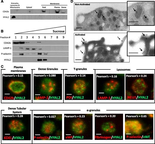 Figure 5. HYAL2 is stored in a distinct subset of α-granules in resting platelets. (A) Immmunoblot analysis for the presence of CD42b and HYAL2 of different platelet subcellular fractions obtained by differential centrifugation. HYAL2 was detected exclusively in the fraction containing granules, lysosomes, and mitochondria (19 000-g pellet), whereas CD42b was detected in the membranes fraction (100 000-g pellet). (B) Platelets were sonicated and applied on top of a linear sucrose density gradient before the gradient was centrifuged at 100 000g for 90 minutes. Nine fractions were collected from the top of the gradient. Equal volumes of fractions were analyzed by immunoblotting for the presence of CD42b (plasma membrane marker), LAMP-1 (lysosomal marker), P-selectin (α-granule marker), and HYAL2. HYAL2 and P-selectin were both enriched in fraction 5, the α-granules fraction, whereas CD42b and LAMP-1 were enriched in fractions 2 and 4, respectively. (C) Confocal microscopy images (maximum projection) of platelets stained for HYAL2 (green) and one of the following proteins: CD42b (plasma membrane marker), LAMP-2 (dense granule marker), protein disulfide isomerase (T-granule marker), KDEL (dense tubular system marker), LAMP-1 and NEU1 (lysosomal markers), P-selectin (α-granule marker), vWF (α-granule marker), and fibrinogen (α-granule marker). HYAL2 did not colocalize with any of the tested markers. Pearson’s correlation coefficients were obtained by analyzing individual images (layers) of the Z-stack using Image-Pro Plus software (Media Cybernetics, Rockville, MD). Image, detection, and software details: Leica TCS SP5 II confocal/multiphoton high-speed upright microscope (Leica), HCX PL APO 63Χ/1.4NA oil immersion objective, Leica HyD system detector, Leica LAS AF software (Leica). Scale bar: 1 µm. (D) Immunoelectron microscopy images showing resting and activated platelets. Washed human platelets were fixed, sectioned, and mounted on formvar-coated nickel grids. Ultrathin platelet sections were probed for HYAL2, and the bound antibody was labeled with immunogold (10 nm). In resting platelets, HYAL2 appeared to be localized within platelet α-granules (black arrows), whereas platelet surface appeared to be devoid of any HYAL2. However, in activated platelets, HYAL2 was clearly detected on the surface. Image and detection details: FEI Tecnai G2 Spirit BioTWIN Transmission Electron Microscope (FEI Company, Hillsboro, OR), Orius 832 CCD 11-megapixel camera, Digitalmicrograph (Gatan, Inc., Pleasanton, CA). Scale bars: 200 nm.