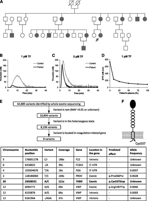 Figure 1. Characterization of the bleeding disorder. (A) Pedigree of the affected family. The proband is indicated by an arrow. Family members with a history of trauma- and/or surgery-related bleeding are marked by closed symbols. (B-D) Thrombin generation experiments. Plasma was activated with the indicated concentrations of TF, 4 μM phospholipids, and 16.6 mM CaCl2. Thrombin generation was measured using calibrated automated thrombography in the patient’s plasma (black lines) or control plasma (gray lines). (D) Mixtures of the patient’s and control plasma in different proportions were activated with 1 pM TF, and the ETP was plotted as a function of the percentage of patient’s plasma in the mixtures. (E) Analysis of the whole exome sequencing data. The 64 885 variants identified in the patient’s DNA were filtered for minor allele frequency (MAF) <0.01 (based on the assumption that the mutation responsible for this bleeding disorder would be rare), for heterozygosity (because of the dominant inheritance pattern of the disorder), and for location in coagulation-related genes. These criteria yielded 8 candidate variants (table), which were further analyzed individually. (F) Schematic representation of the TM molecule anchored to the endothelial membrane. The position of the Cys537 residue is indicated.