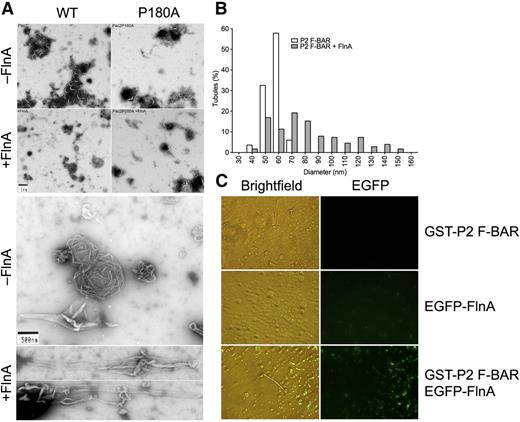 Figure 3. FlnA potentiates PACSIN2 F-BAR domain membrane tubulation in vitro. (A) PC/PS liposomes were incubated with GST-PACSIN2 F-BAR domain WT or P180A in the presence or absence of His-FlnA constructs, as indicated. Membrane tubulation capacity was assessed in the electron microscope. (B) Diameter of membrane tubules generated by GST-PACSIN2 (P2) F-BAR domain in the presence or absence of His-FlnA. (C) PC/PI liposomes were incubated with GST-PACSIN2 (P2) F-BAR domain and/or EGFP-FlnA and observed by light and fluorescence microscopy.