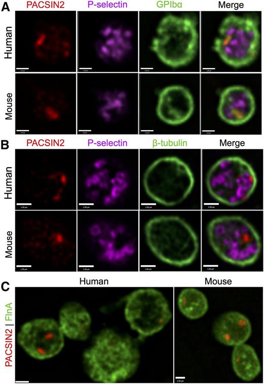 Figure 4. PACSIN2 localization in human and mouse platelets. High-resolution SDM of (A) PACSIN2 (red), P-selectin (magenta), and GPIbα (green) in fixed human and mouse platelets; (B) PACSIN2 (red), P-selectin (magenta), and β-tubulin (green) in fixed human and mouse platelets; and (C) PACSIN2 (red) and FlnA (green) in fixed human and mouse platelets. Most platelets show 1 to 2 distinct concentrated PACSIN2 foci, which may also be distributed throughout the cells. Scale bars represent 1 µm.