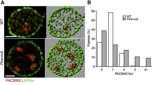 Figure 5. PACSIN2 localization in WT and Flna-null platelets. (A) Super-resolution SIM of PACSIN2 (red) and GPIbα (green) in typical fixed WT and Flna-null mouse platelets (left). Fields were rendered in Volocity extended focus mode (right). Scale bars represent 1 µm. (B) Fields rendered were scored for the presence of defined PACSIN2 foci at a constant contrast setting. Total platelets scored were 244 WT and 208 Flna null.