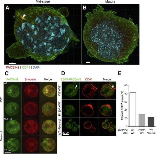 Figure 6. PACSIN2 localization in bone marrow MKs requires FlnA. Super-resolution SIM of PACSIN2 (red), CD41 (green), and DAPI (blue) in fixed (A) midstage and (B) mature matrigel-cultured WT mouse MKs. Arrowhead indicates tubule-associated PACSIN2 concentration. Scale bars represent 2 and 3 µm, respectively. (C) Confocal microscopy of PACSIN2 (green) and β-tubulin (red) in fixed cultured WT (upper) and Flna-null mouse (lower) bone marrow MKs. Scale bar represents 20 µm. (D) Confocal microscopy of EGFP-PACSIN2 WT or mutant P180A (green), and CD41 (red) in fixed control and Flna-null cultured cytospun bone marrow MKs, as indicated. Scale bar represents 20 µm. (E) Percentage of transfected MKs with defined EGFP-PACSIN2+ membrane tubulation was scored. Total MKs scored were 46 WT and 18 Flna null.