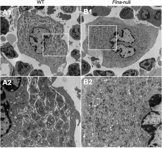 Figure 7. Altered ultrastructure of Flna-null bone marrow MKs. Transmission electron microscopy analysis of freshly isolated bone marrow (A) WT and (B) Flna-null MKs. Areas within boxes in micrographs A1 and B1 are shown at higher magnification in A2 and B2, respectively. Scale bars represent 2 µm at ×5000 magnification (upper) and 500 nm at ×15000 magnification (lower).