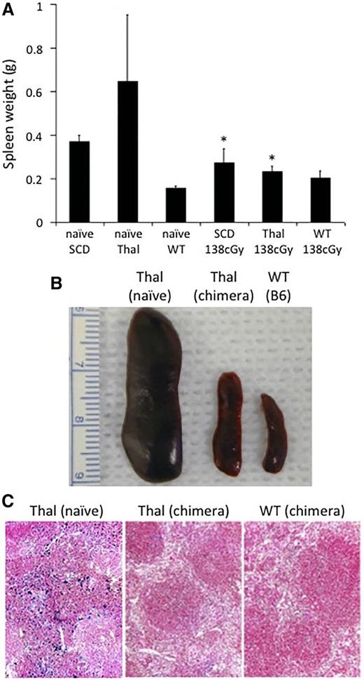 Figure 5. Splenic weight and iron deposition in chimeric hemoglobinopathy mice following IUHCT + postnatal BMT. Spleens from chimeric SCD (n = 4) and Thal (n = 5) mice who had undergone a postnatal “booster” transplant were harvested at 40 weeks of age and their weight was compared with age-matched naïve SCD mice (n = 6), Thal mice (n = 7), B6 WT (n = 6), and B6 WT chimeric mice boosted following 138 cGy TBI (n = 4). *P < .05 vs corresponding naïve SCD or Thal mice (A-B). Spleens were evaluated by histology for iron deposition in chimeric Thal mice following postnatal BMT and compared with age-matched naïve Thal and chimeric B6 WT controls (C).