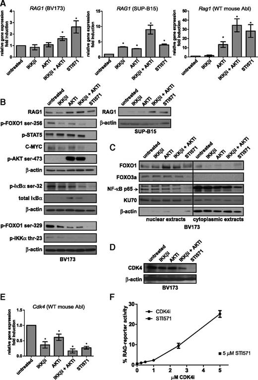 Figure 2. Transcriptional regulation of RAG1 by the AKT and NF-κB pathways. (A) Real-time reverse transcription PCR (RT-PCR) analysis of RAG1 mRNA in the human BCR-ABL-positive B-ALL cell lines BV173 (left) and SUP-B15 (middle) and Rag1 mRNA in the WT mouse Abl pre-B cell line (right). Cells were treated with 2.5 μM IKKβi, 2.5 μM AKTi, or 10 μM STI571 for 48 hours. (B) Immunoblot analysis of whole-cell extracts from BV173 and SUP-B15 cells treated as in (A). (C) Immunoblot analysis of nuclear and cytoplasmic extracts from BV173 cells treated as in (A). (D) Immunoblot analysis of CDK4 cells treated as in (A). β-actin was used as loading control in (B) and (D). KU70 is expressed in the nucleus and the cytoplasm and was used as loading control in (C). (E) Cdk4 real-time RT-PCR analysis of the WT mouse Abl pre-B cell line; cells were treated as in (A), and results were normalized to those in untreated cells (DMSO vehicle). Real-time RT-PCR results are presented relative to the expression of the housekeeping genes RPLPO (for human cells) and 18S ribosomal RNA (rRNA) (mouse cells); PCRs were performed at least in duplicate, and error bars show means ± SD of 3 independent experiments. (F) Titration curve of CDK4i. RAG-reporter activity of WT mouse Abl pre-B cells treated with 5 μM STI571 is plotted against the concentration of CDK4i. Cells were stimulated for 96 hours. A representative example of 3 independent experiments is shown, 4 replicate measurements were performed per experiment, and error bars represent means ± SD. *P < .05, as determined by the 1-sample Student t test.