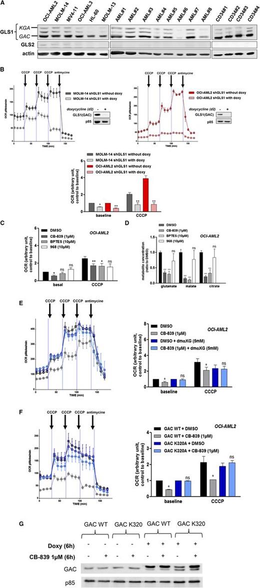 Figure 2. GAC protein is prominently expressed in AML and modulates the OCR. (A) Analysis of human leukemic cell lines. AML cells from 8 patients and normal CD34+ HPCs from 4 healthy donors were analyzed by western blotting using anti-GLS1, anti-GLS2, and anti-ACTIN antibodies. (B) MOLM-14 (left) and OCI-AML2 (right) cells were transfected with a lentiviral vector expressing a doxycycline-inducible GLS1 shRNA (#5) construct. Stably infected cell lines were established by puromycin selection. After 2 days of doxycycline exposure, the OCR was measured using a Seahorse XF96 extracellular flux analyzer under both basal conditions and after the addition of CCCP and antimycin, as indicated. The inhibition of GAC expression was controlled in western blots using anti-GAC antibody. Histograms show data that are representative of 3 independent experiments. (C) OCI-AML2 cells were cultured with or without CB-839 (1 µM), BPTES (10 µM), or compound 968 (10 µM) for 6 hours, and the OCR was measured using a Seahorse XF96 extracellular flux analyzer. Histograms show data that are representative of 3 independent experiments. (D) OCI-AML2 cells were cultured with or without CB-839 (1 µM), BPTES (10 µM), or compound 968 (10 µM) for 4 hours, and 5 × 106 cells were washed twice in cold PBS; the pellet was frozen and each indicted metabolite was measured. (E) OCI-AML2 cells were cultured with or without CB-839 (1 µM) and αKG (5 mM) for 6 h, and the OCR was measured. Histograms show data that are representative of 3 independent experiments. (F) OCI-AML2 cells were transfected with a lentiviral vector expressing a doxycycline-inducible V5-tagged GACWT or GACK320A construct. Stably infected cell lines were established by puromycin selection. After 6-hour doxycycline exposure with or without CB-839, the OCR was measured under both basal conditions and after the addition of CCCP and antimycin, as indicated. Histograms show data that are representative of 3 independent experiments (G) OCI-AML2 cells stably infected with GACWT or GACK320A were cultured for 6 hours with or without doxycycline or CB-839 (1 µM) and were analyzed by western blotting using anti-GAC and anti-ACTIN antibodies. *P < .05, **P < .01, ***P < .001.