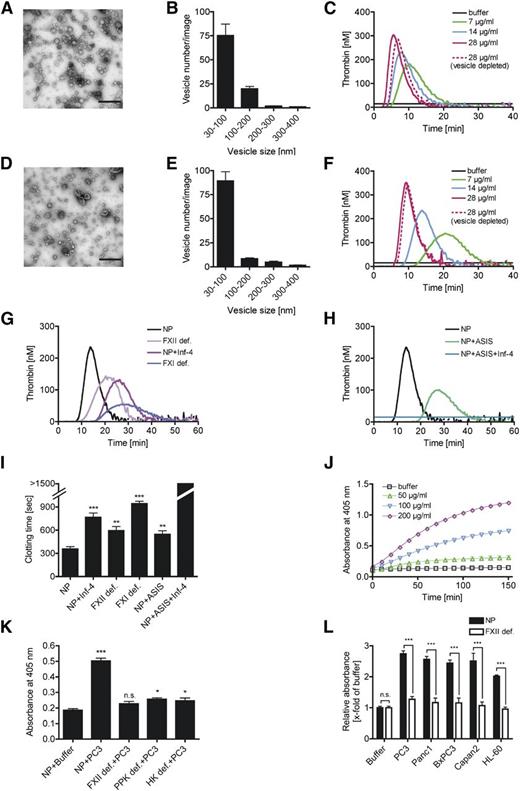 Figure 2. Prostasomes trigger coagulation in a FXII-dependent manner. Comparison of (A-C, upper) seminal and (D-F, lower) PC3 cell prostasomes: TEM images show morphologies of isolated (A) seminal and (D) PC3 prostasomes (bar, 500 nm). Size distributions of (B) seminal and (E) PC3 prostasomes assessed from TEM images as shown in A and D, 6 fields each. Real-time thrombin generation stimulated with increasing concentrations (0-28 µg/mL) of (C) seminal and (F) PC3 prostasomes in platelet-free (solid lanes) and ultracentrifuged (dashed line) plasma. Representative curves of a series of n = 6 are shown. (G-H) Mechanism of prostasome-driven coagulation: real-time thrombin generation initiated by 14 µg/mL PC3 prostasomes in NP, NP supplemented with rHA-Infestin-4 (Inf-4; 500 µg/mL), ASIS (30 nM), or a combination of ASIS and Inf-4 (30 nM and 500 µg/mL) and plasma deficient in FXII (FXII def.) or FXI (FXI def.); n = 3 to 11. (I) PC3 prostasome (1.75 µg/mL)-stimulated recalcification clotting time in ultracentrifuged NP in the presence of inhibitors as in G and H or buffer or in FXII- or FXI-deficient plasma. **P < .01 and ***P < .001 vs NP, n = 5. (J-L) Contact activation was analyzed by conversion of the FXIIa/PK chromogenic substrate S-2302. Buffer stimulated plasma is shown as control. (J) Plasma was incubated with increasing concentrations of PC3 prostasomes (0-200 µg/mL). (K) PC3 prostasome (100 µg/mL)-induced S-2302 conversion in NP or plasma deficient in FXII (FXII def.), prekallikrein (PPK def.), or high-molecular-weight kininogen (HK def.). *P < .05 and ***P < .001 vs NP + buffer. Bars represent the absorbance at λ = 405 nm at 60 minutes; n = 6. (L) Normal (dark columns) or FXII-deficient (light columns) plasma was incubated with PC3 prostasomes and exosomes from various cancer cells (Panc1, BxPC3, Capan2, and HL-60; 100 µg/mL each). Absorbance of cleaved S-2302 in prostasome-treated plasma is given relative to buffer signal at 60 minutes. ***P < .001 NP vs FXII def., n = 3 to 6. P values were determined using 1-way ANOVA (I,K) or Student t test (L). Data are presented as mean ± SEM; n.s., nonsignificant.