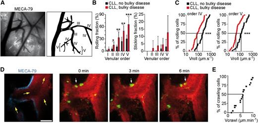 Figure 3. CLL cells roll, stick, and crawl within LN HEVs in vivo. (A) Visualization of the mouse inguinal LN microcirculation by intravital microscopy. HEV blood vessels were revealed by IV injection of Alexa 488–conjugated MECA-79 Ab. The different blood vessel orders are indicated (I-V). (B) Rolling and sticking of human CLL cells within mouse LN HEVs. The rolling fraction (left panel) and sticking fraction (right panel) of calcein-labeled CLL cells in the indicated venules are shown. Data represent the mean ± SD of independent experiments conducted with CLL cells from 7 CLL patients with no bulky disease (black) and 6 CLL patients with bulky disease and high circulating lymphocyte counts (≥40 000 cells/mm3; red). Unpaired t test; *P < .05, **P < .01, ***P < .001. (C) CLL cells from patients with bulky disease roll more slowly within LN HEVs. Data represent the percentages of rolling cells at or below a given velocity (Vroll) in the indicated venules. The median velocity of cells from CLL patients with no bulky disease was 220.7 and 124 µm.s−1 in order IV and V, respectively. The median velocity of cells from CLL patients with bulky disease was 79.6 and 48.3 µm.s−1 in order IV and V, respectively (50 cells/venular order from 5 patients were analyzed). Mann-Whitney test; ***P < .001. (D) Two-photon microscopy time-lapse images showing CFSE-labeled CLL cells from patients with bulky disease (arrowheads) crawling on HEV endothelium. Alexa 647–conjugated MECA-79 staining is shown on the first image. Yellow arrows indicate blood flow direction. Scale bar, 40 µm. (E) The median crawling speed (Vcrawl) was determined from 2 independent experiments (n = 21 cells).