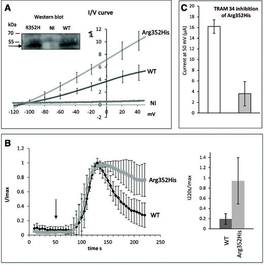 Figure 2. Functional analysis of the Gardos channel variant p.Arg352His. (A) Current-voltage curves of WT and mutated KCNN4 in oocyte membranes with quantification. I/V curves correspond to the maximal current recorded for WT or p.Arg352His KCNN4-expressing oocytes (around 135 seconds) in gluconate medium with 1 µM A23187. Data are means of ramps recorded on 15 (WT) or 22 (p.Arg352His) oocytes. NI are control (noninjected) oocytes (n = 4). (Inset) Western blot detection of WT and mutated KCNN4 indicated by the arrow (around 50 kDa). (B) Activation kinetic. For oocytes expressing WT KCNN4 or p.Arg352His KCNN4, the current measured in gluconate medium at 0 mV was plotted as a function of time (left). The maximal intensity of the current being different between WT and mutated KCNN4, a ratio between I at different times and the Imax was calculated for each condition and plotted as a function of time. Data are means of 15 (WT) or 22 (p.Arg352His) oocytes coming from 3 different batches. The arrow indicates the opening of calcium ionophore perfusion. The addition of A23187 did not stimulate any current in noninjected oocytes; for clarity, the NI trace was not plotted on this graph. The bar graph (right) quantifies the remaining current at 220 seconds in oocytes expressing WT or p.Arg352His KCNN4. The current at 220 seconds was divided by Imax (at about 135 seconds) for each recording. Data are means ± standard error of the mean (SEM) of 15 (WT) or 22 (p.Arg352His) oocytes. Statistical analysis was done using the Mann-Whitney test; the 2 bars are different with a risk of 0.2% (bidirectional). (C) TRAM34 inhibition: once the maximal current was reached in oocytes expressing p.Arg352His mutant, 10 µM TRAM34 was added. This induced a rapid current decrease. The mean value of maximal currents at 50 mV was calculated (white bar) and compared with the mean value of minimal currents at 50 mV after TRAM34 addition (gray bar). Data are means of 4 oocytes ± SEM.